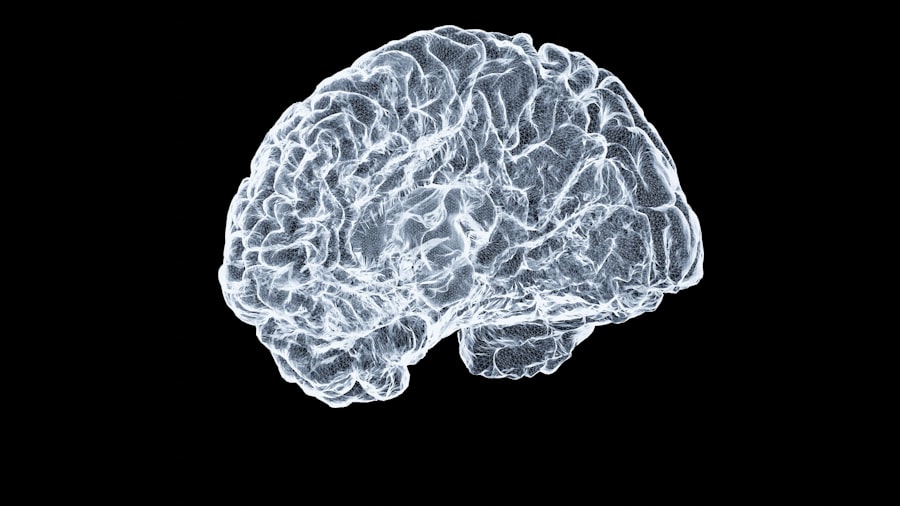 Brain scan